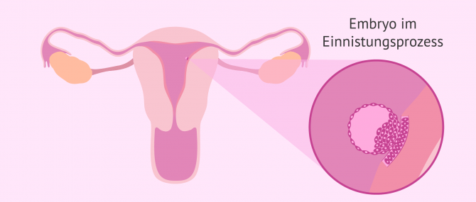 Imagen: Embryo nistet sich in die empfängliche Gebärmutterschleimhaut ein
