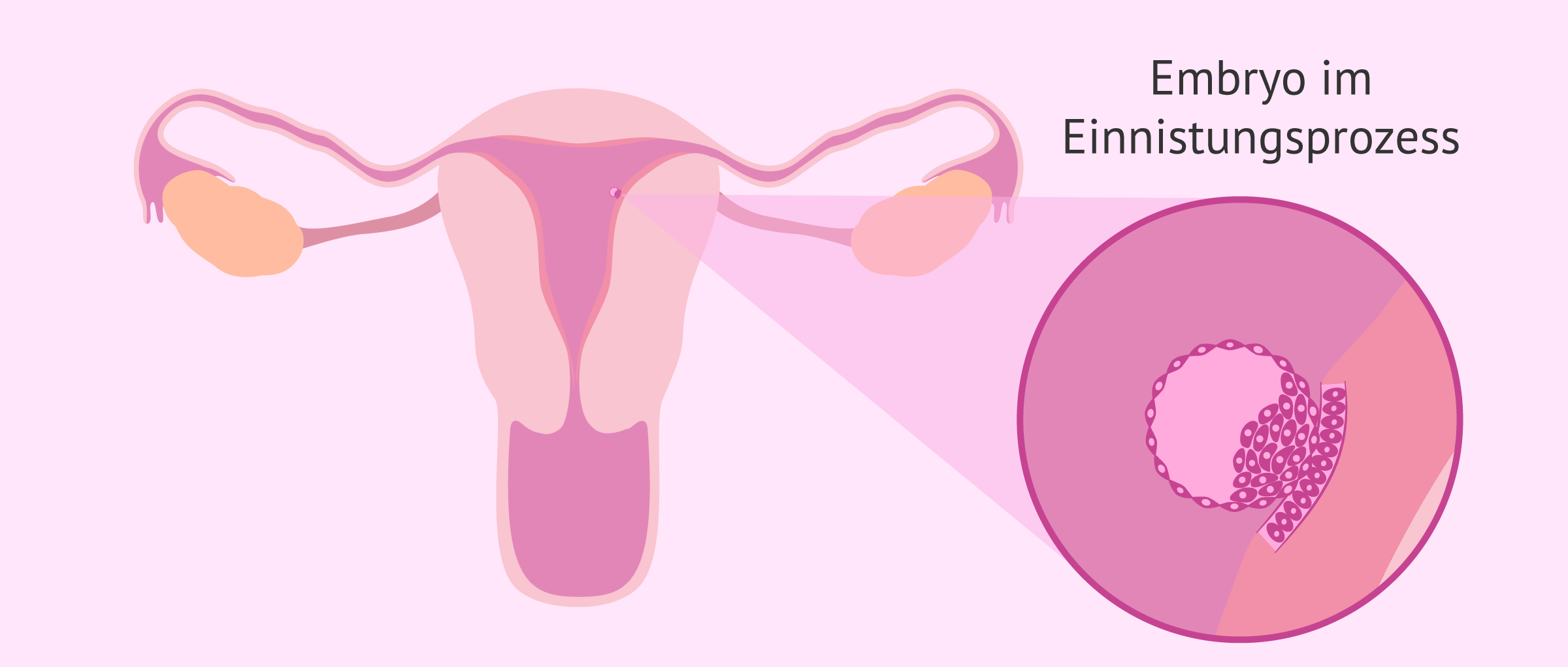 Embryo nistet sich in die empfängliche Gebärmutterschleimhaut ein