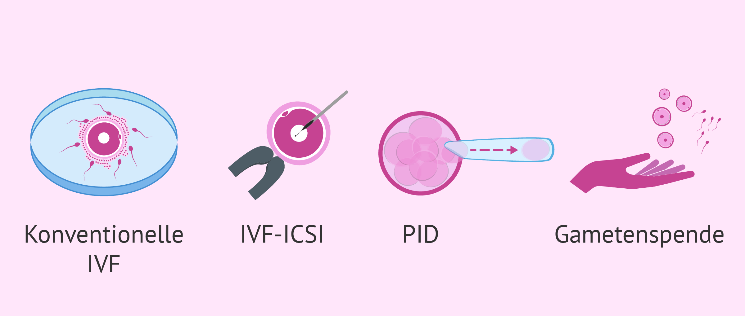IVF in der Leihmutterschaft