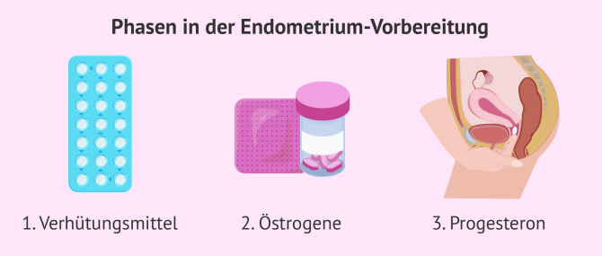 Imagen: Phasen der Endometriumvorbereitung