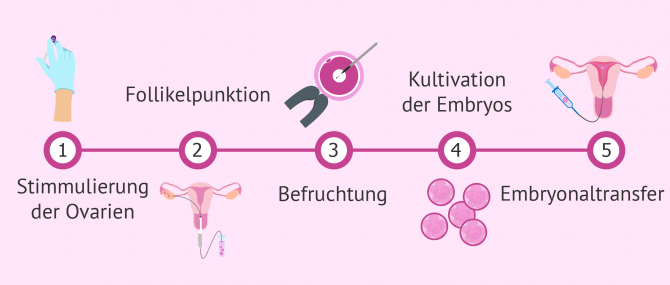 Imagen: Ablauf in der In-vitro-Fertilisation