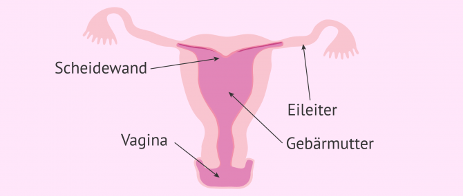 Imagen: Uterus arcuatus