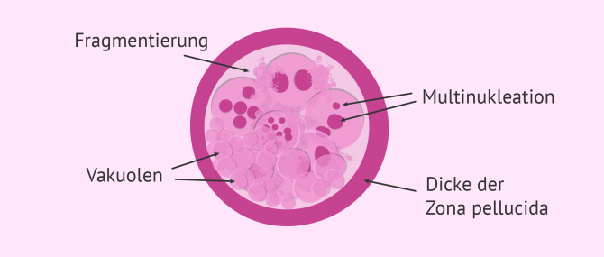 Imagen: Morphologische Kriterien zur Embryoklassifizierung