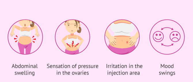 Imagen: ovarian stimulation symptoms