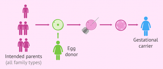 IVF surrogacy using donor eggs