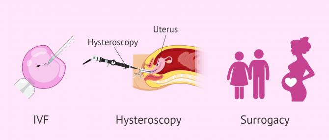 Imagen: Types of uterine abnormalities