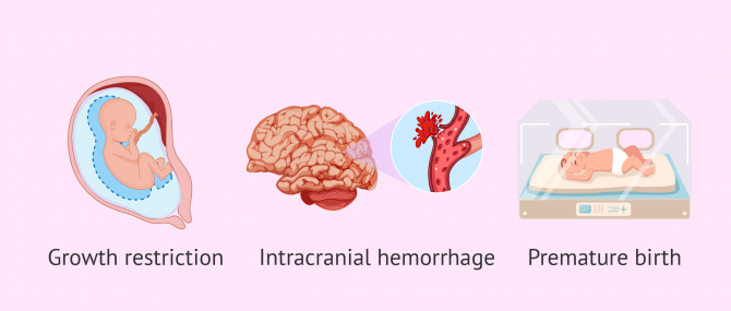 types of heart disease in pregnancy