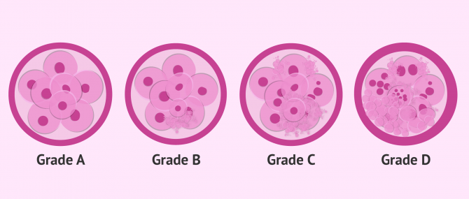 Imagen: embryo quality classification