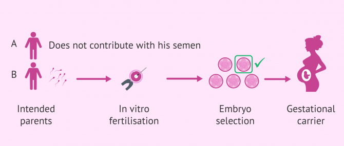 Imagen: Only one partner provides semen