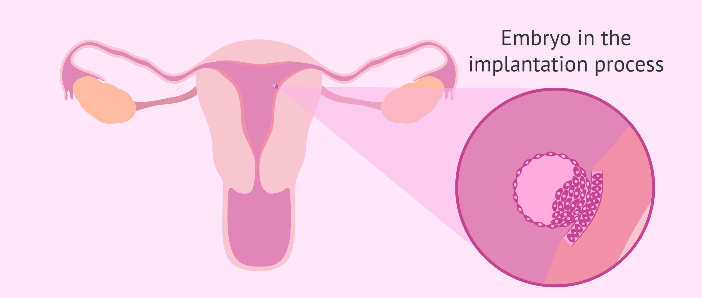 Embryo implantation into the receptive endometrium