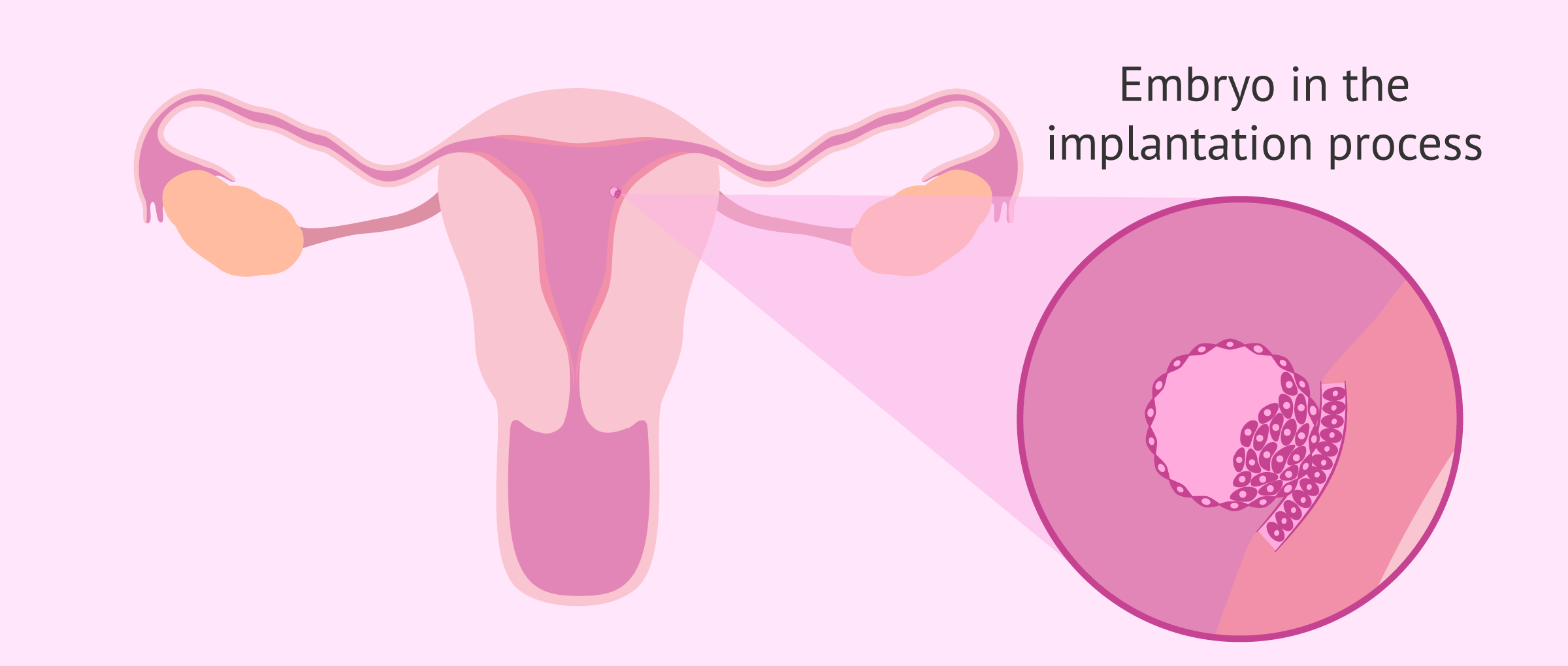 implantation of embryo in uterus