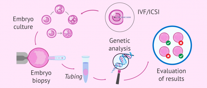 Imagen: Process of PGD (Preimplantational Genetic Diagnosis)