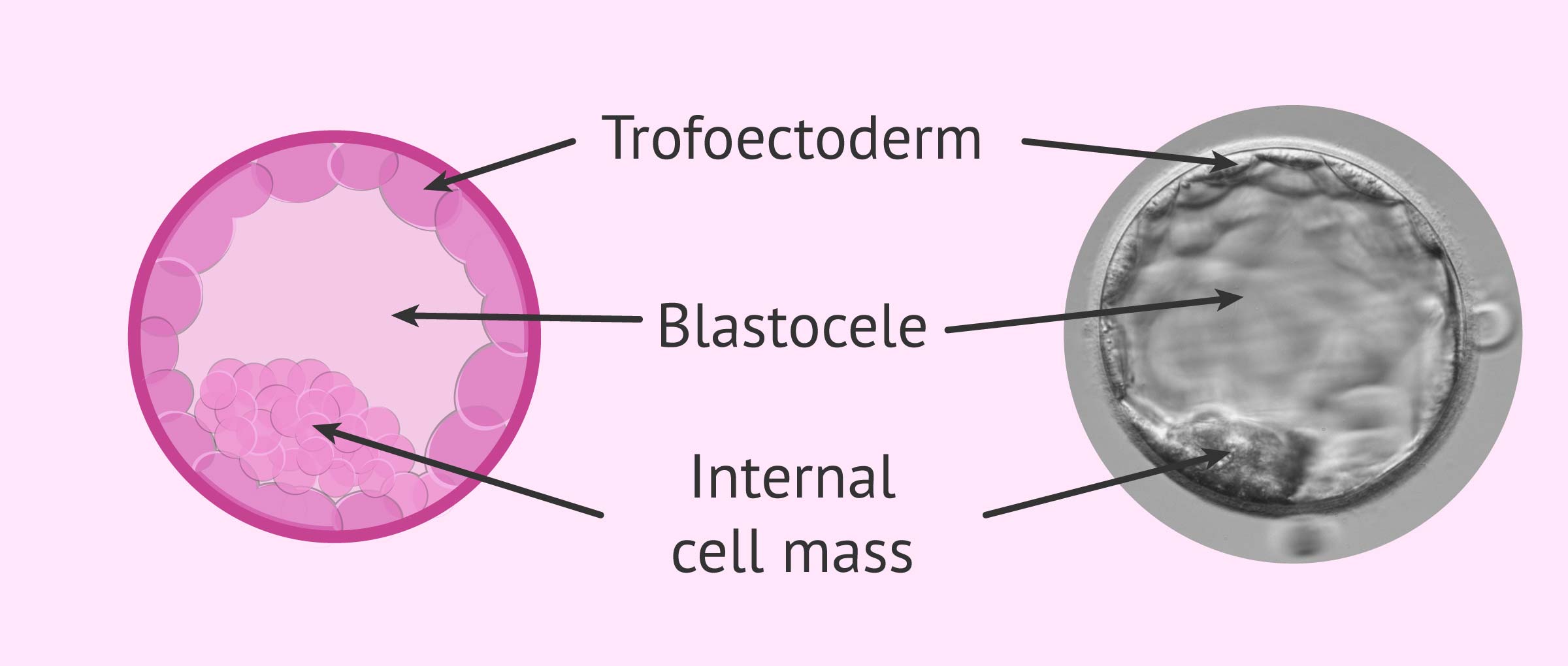 Blastocyst stage