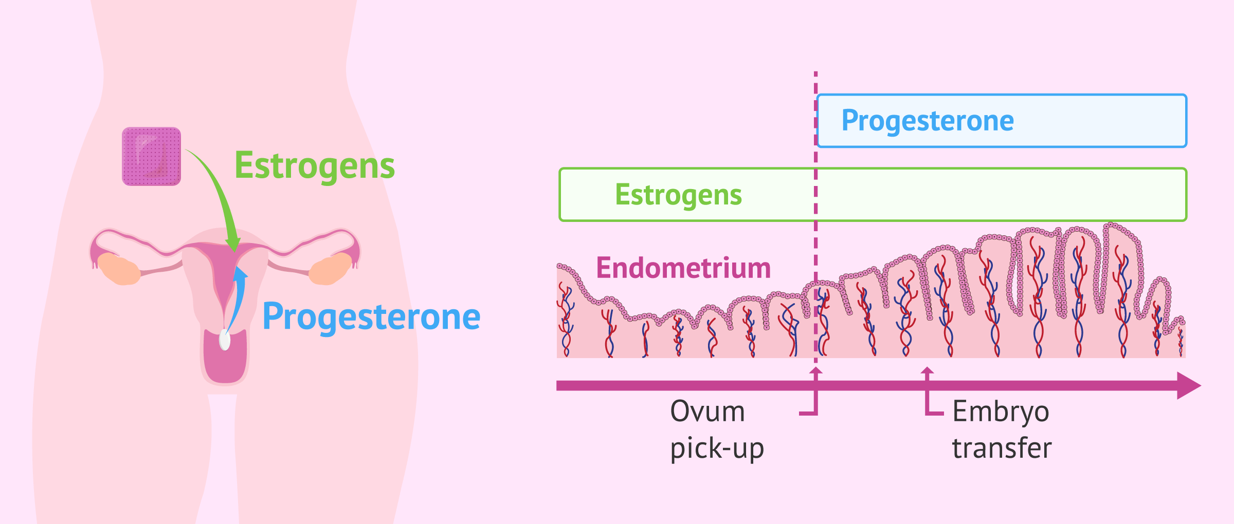 Endometrial preparation for embryo transfer