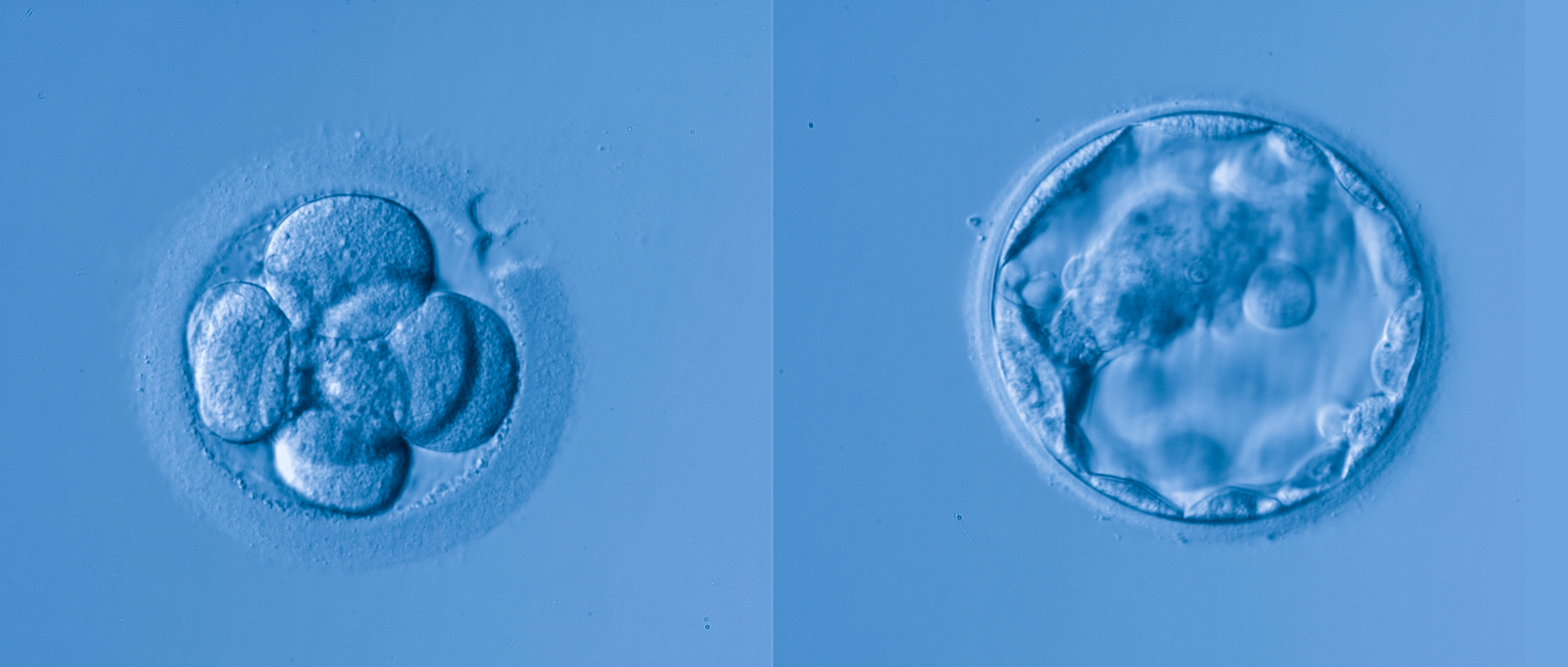 Embriones en día 3 y día 5