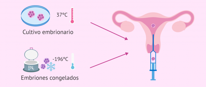 Imagen: Transferencia de embriones en fresco o congelados