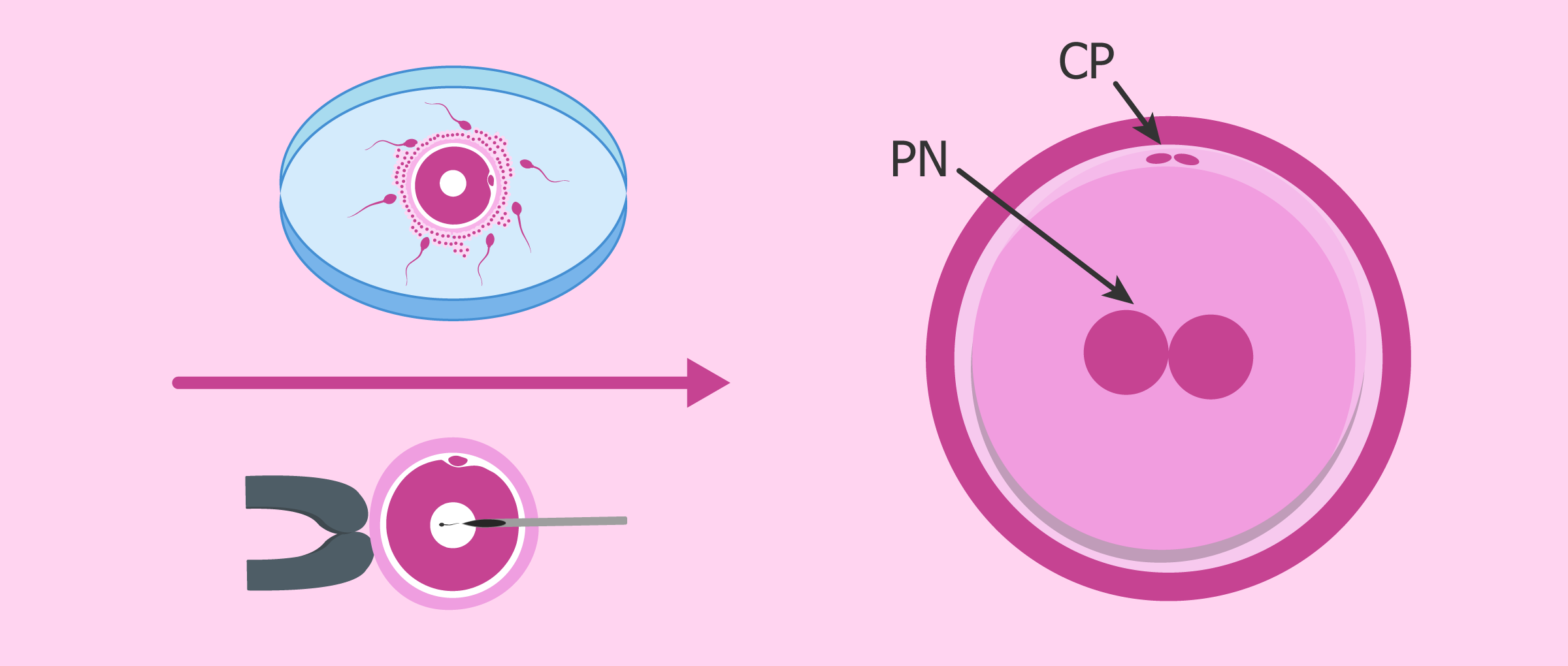 Embrión en día 1: cigoto