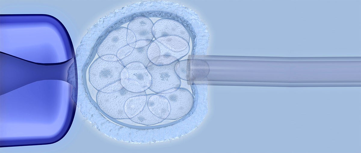 Manipulación del embrión en el DGP