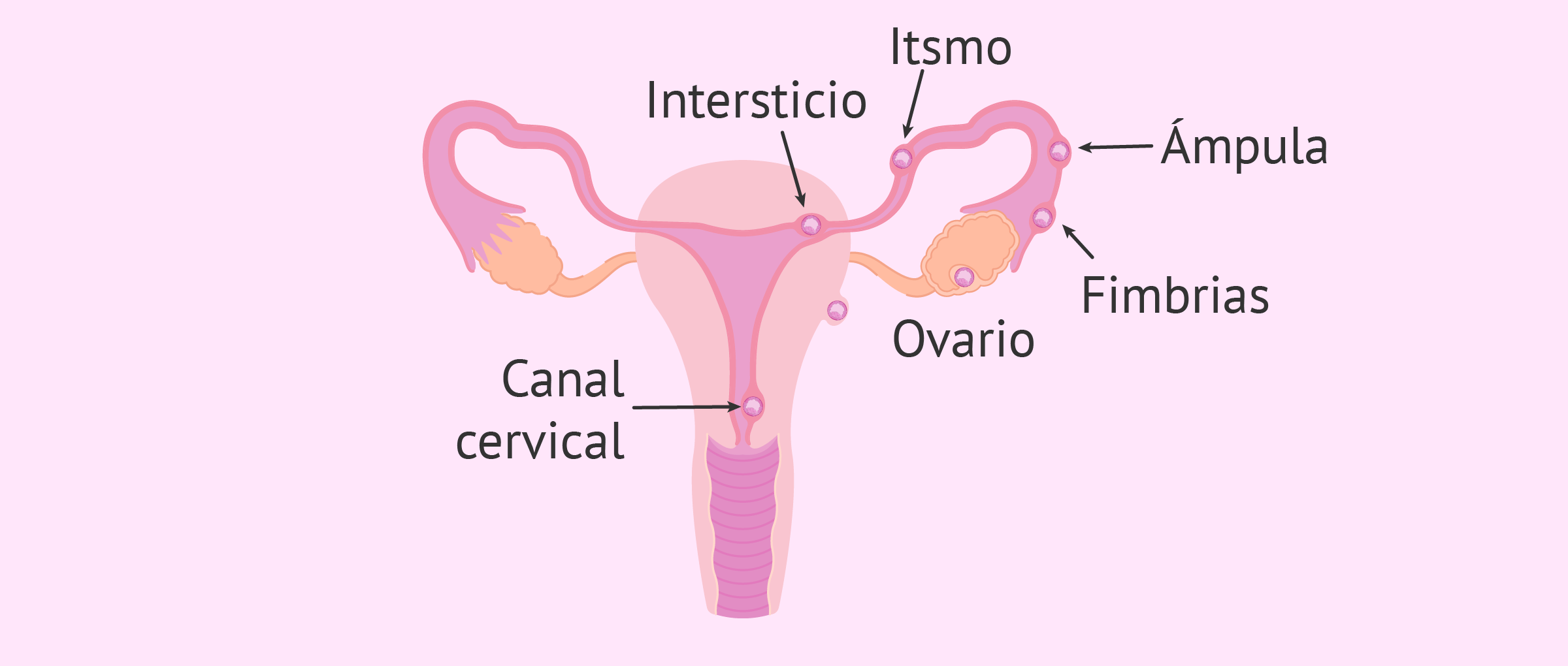 Lugares de implantación del embrión en un embarazo ectópico