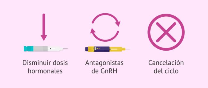 Imagen: Prevenir el síndrome de hiperestimulación ovárica