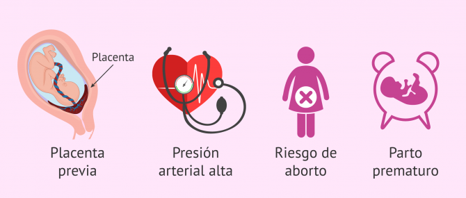 Imagen: Transferencia única para evitar embarazo múltiple