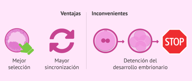 Imagen: Ventajas e inconvenientes de transferir embriones en día 5
