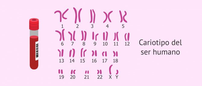 Imagen: Estudio del cariotipo masculino en el análisis de fertilidad