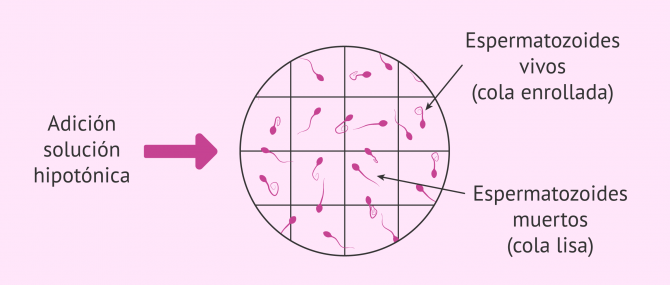 Imagen: Test hiposmótico para medir la integridad de la membrana espermática