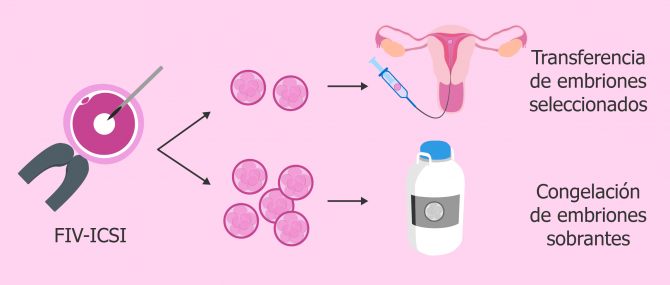 Criopreservación de embriones sobrantes