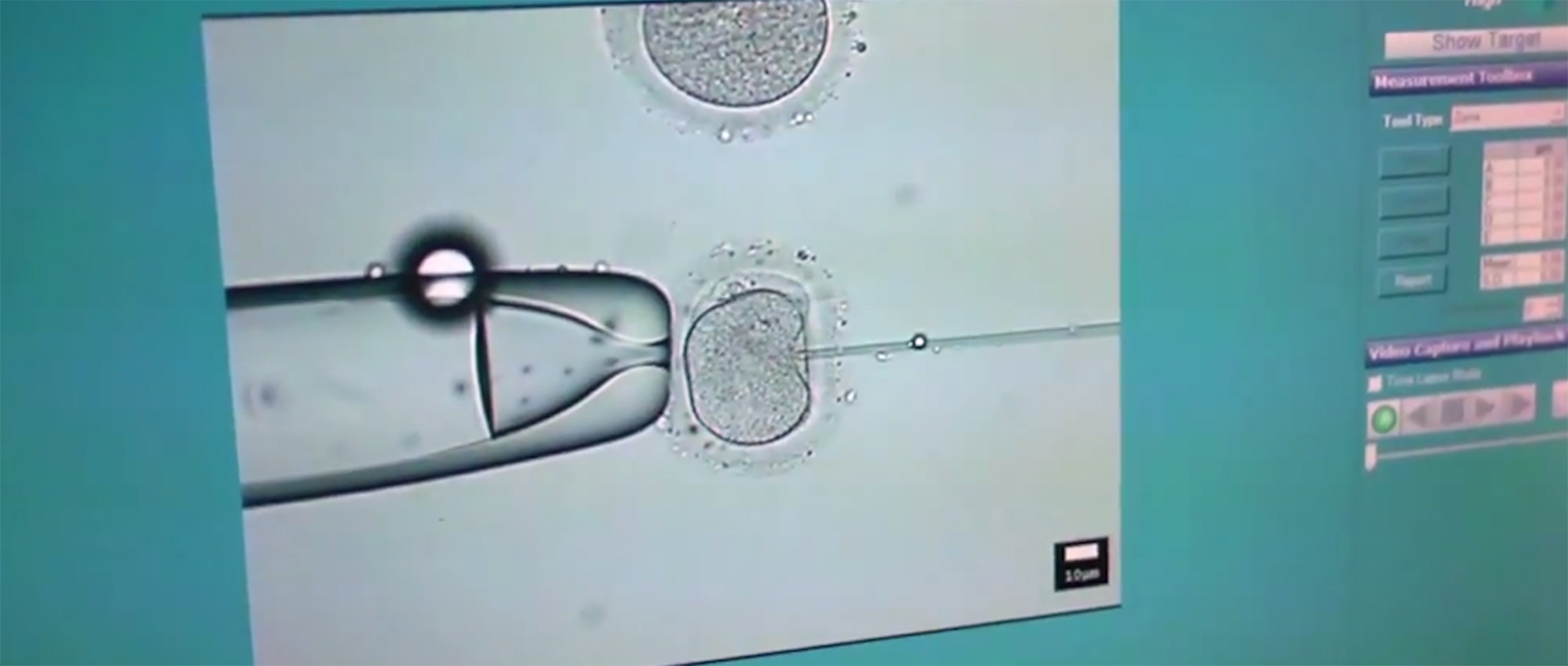 Analizar genéticamente los embriones antes de la transferencia
