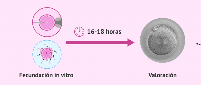 Imagen: Valoración de la fecundación en el laboratorio