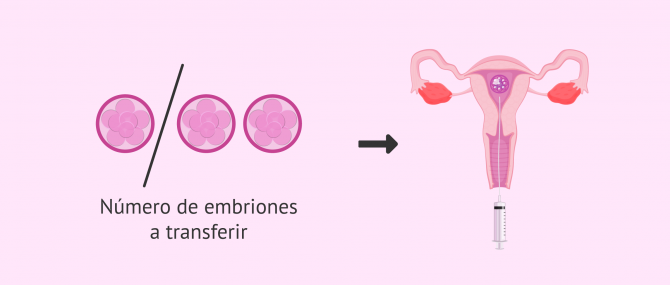 Imagen: ¿Cuántos embriones se trasfieren?