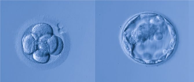 Développement du blastocyste