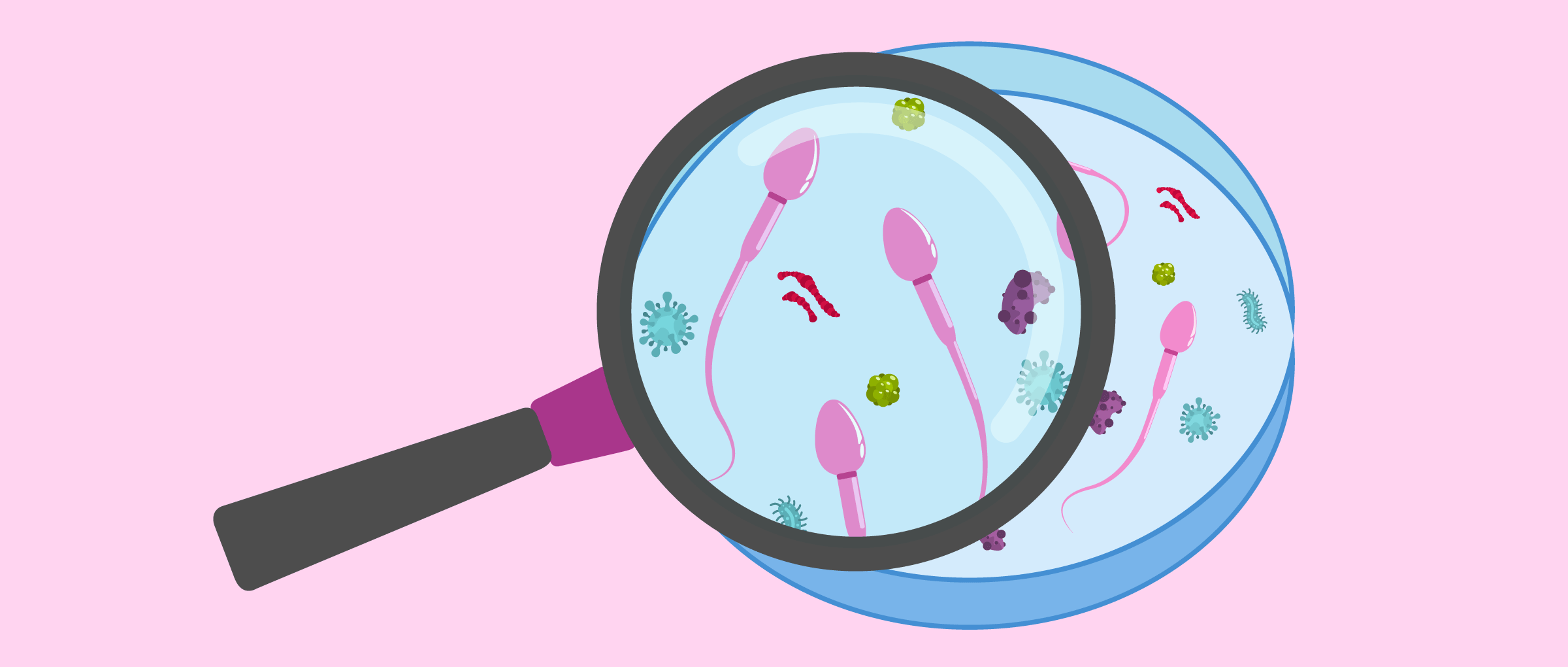 Imagen: Culture de sperme pour chercher une infection