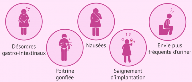 Imagen: Symptômes implantation