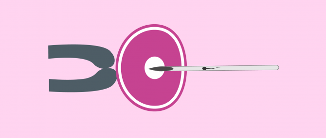 Imagen: Micro-injection du spermatozoïde dans l'ovule